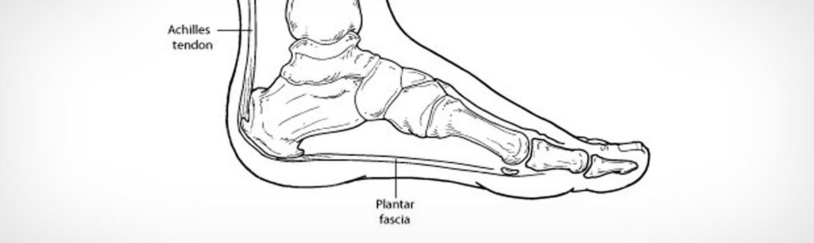 heel-pain-featured